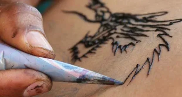 Δείτε τι έπαθε 12χρονη από τατουάζ χένας στη Κρήτη (Μοίρες pics)