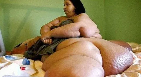 Την θυμάστε αυτή τη γυναίκα; Έχασε 362 κιλά! Δείτε πως είναι σήμερα δεν θα πιστεύετε στα μάτια σας [photo+video]