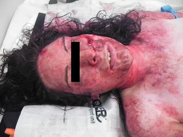 Η κρουαζιέρα του τρόμου: Καμαρότος βίασε και κακοποίησε βάναυσα επιβάτιδα (εικόνες)