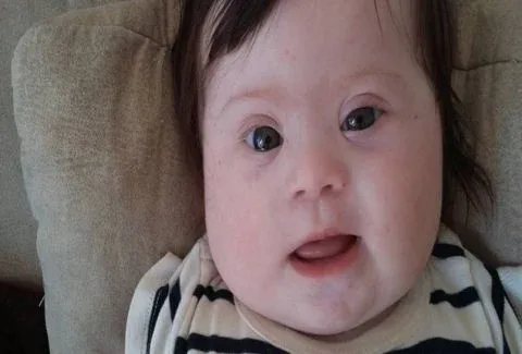 Αυτή είναι η Λουίζα, το 4 μηνών μωράκι που έχει δύο χέρια, δύο πόδια, κι ένα έξτρα χρωμόσωμα! – Το άρθρο που πρέπει να διαβάσεις!