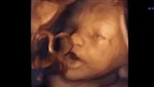 Απίστευτο βίντεο: Μωρό «τραγουδάει» μέσα στην κοιλιά της μητέρας του!