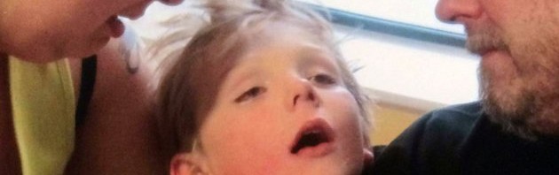 Γονείς δημοσιοποιούν φωτογραφία του παιδιού τους τη στιγμή ξεψυχάει από μηνιγγίτιδα (εικόνες)