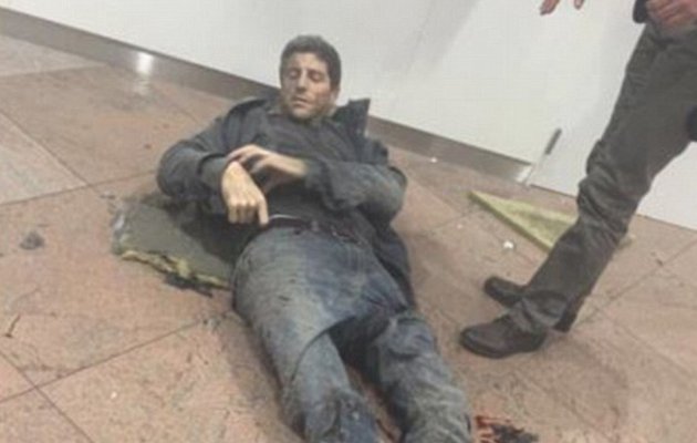 Sebastien Bellin: Ο τραυματίας των Βρυξελλών που η φωτογραφία του κάνει το γύρο κόσμου (εικόνες)
