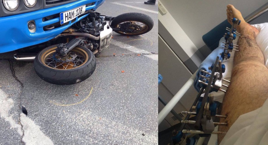 Συγκλονίζουν τα λόγια 23χρονου μοτοσικλετιστή που τραυματίστηκε σε τροχαίο «Προτιμώ να σοκάρω με τις φωτογραφίες αλλά…»