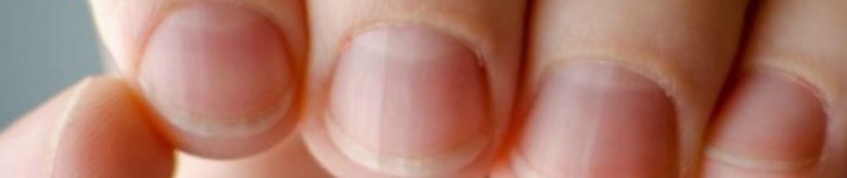 5 ύπουλα προβλήματα υγείας που φαίνονται στα νύχια (εικόνες)