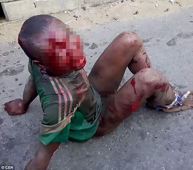 Λιντσάρισαν και έκαψαν 7χρονο παιδάκι επειδή έκλεψε λίγο….. φαγητό. (Εικόνες που Σοκάρουν)