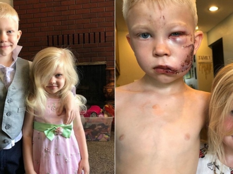 6χρονος σούπερ ήρωας έσωσε την αδελφή του και απέκτησε….90 ράμματα