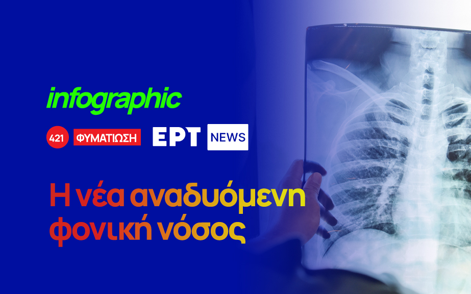 Infographic: Αποκαλυπτική έκθεση του ΠΟΥ για τη φυματίωση